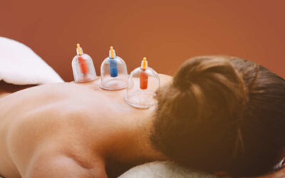 Top 10 Ways Cupping Therapy Can Help You